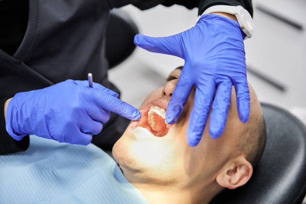 Best Emergency Broken Tooth Repair in Meadville, PA